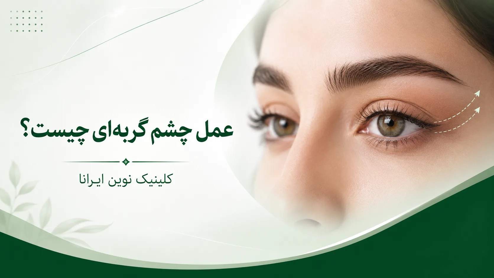عمل چشم گربه ای چیست؟